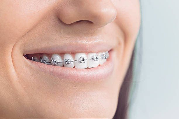 Best Dental Bonding  in Washington, NC